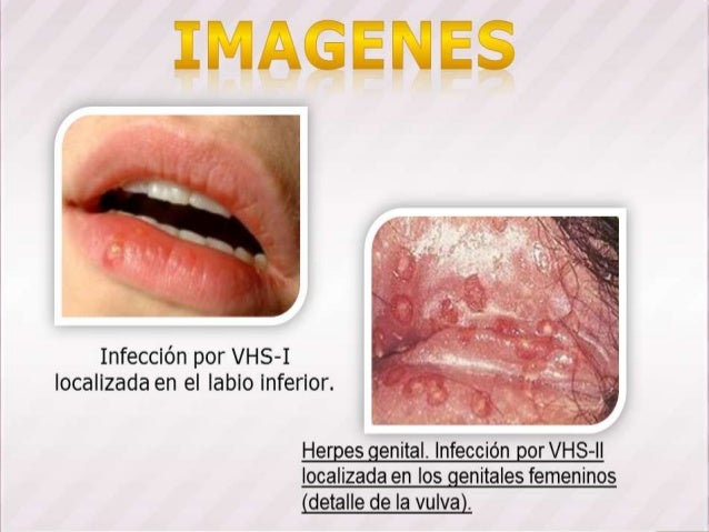 Enfermedades de transmision sexualidad pdf picture 22